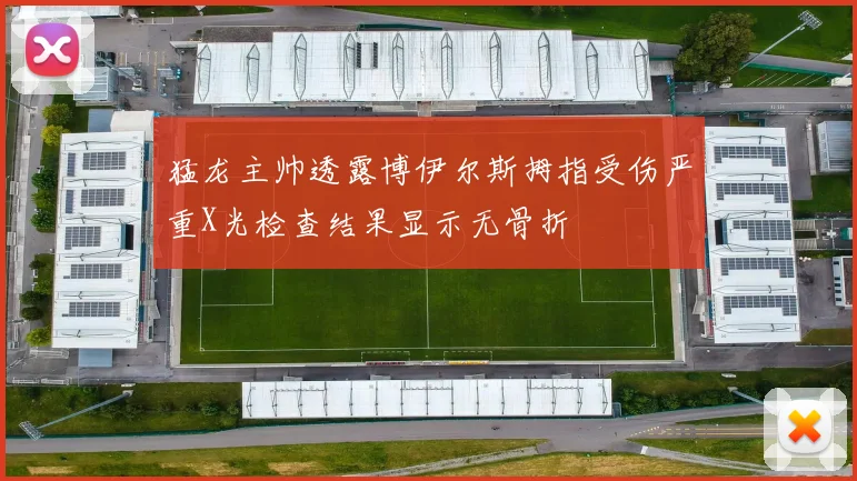 猛龙主帅透露博伊尔斯拇指受伤严重X光检查结果显示无骨折
